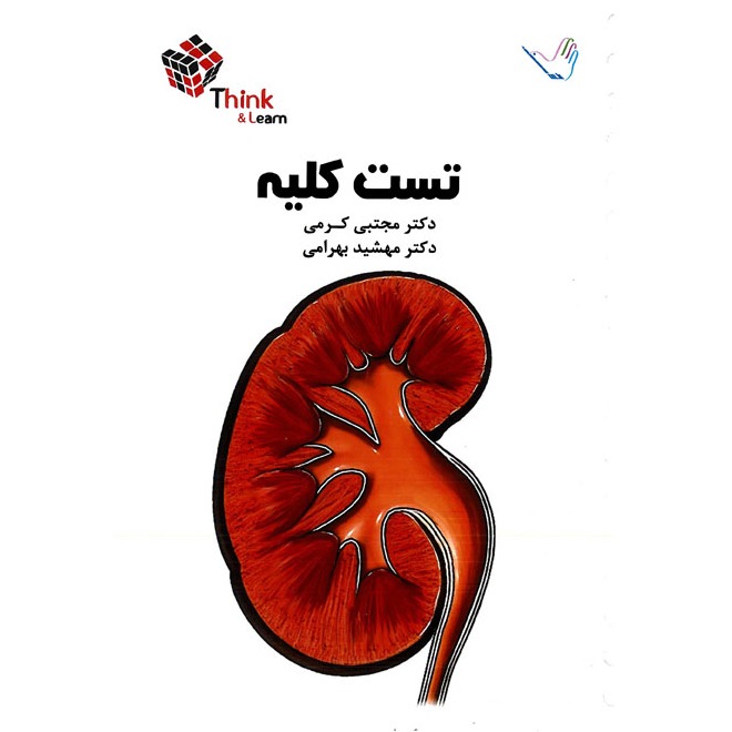 خبر شماره 258 : تست داخلی کلیه کرمی براساس رفرنس جدید منتشر شد	
