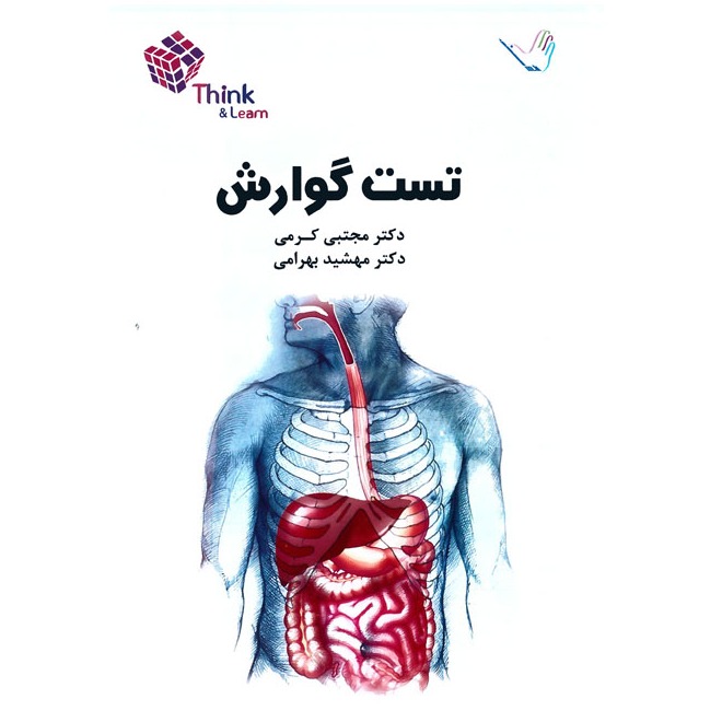 خبر شماره 256 : تست داخلی گوارش کرمی براساس رفرنس جدید منتشر شد	